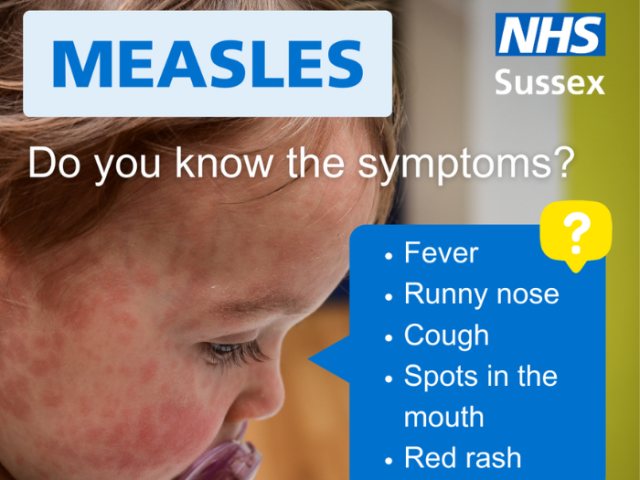 NHS graphic with a photo of a child with measles and a list of the main symptoms