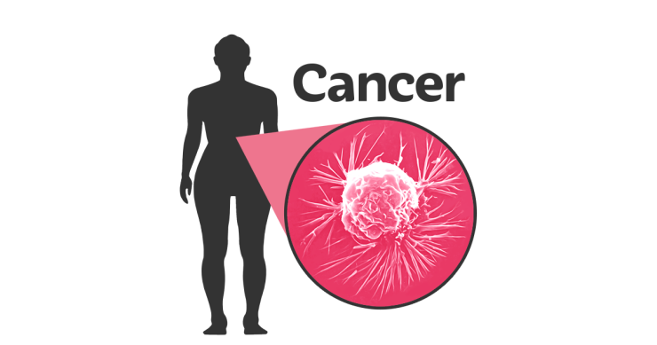 A figure next to the word cancer.